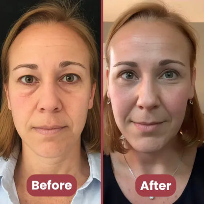 Rédelisse™ Red Light Eye Massager