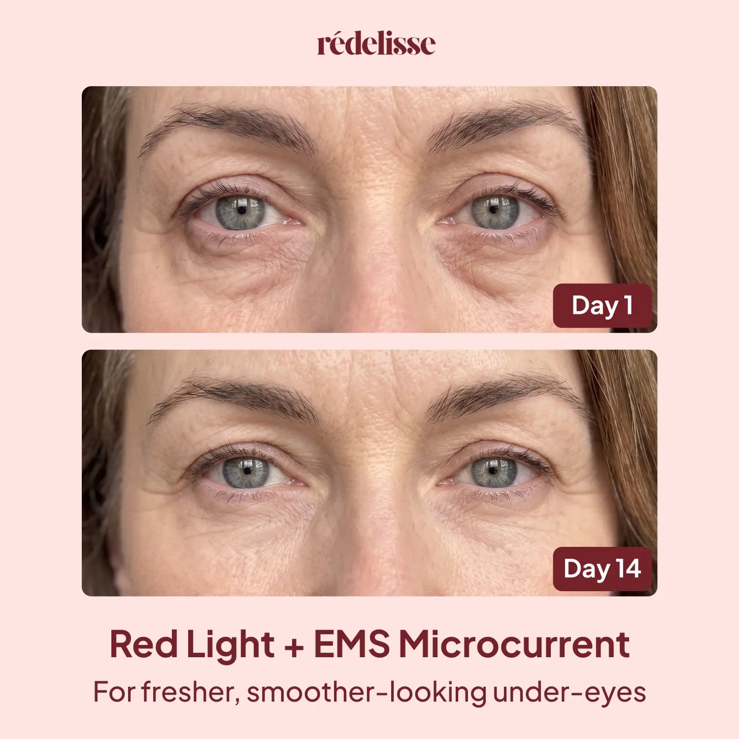 Rédelisse™ Red Light Eye Massager