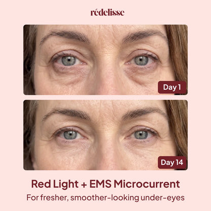 Rédelisse™ Red Light Eye Massager