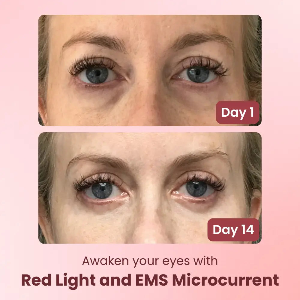 Rédelisse™ Red Light Eye Massager