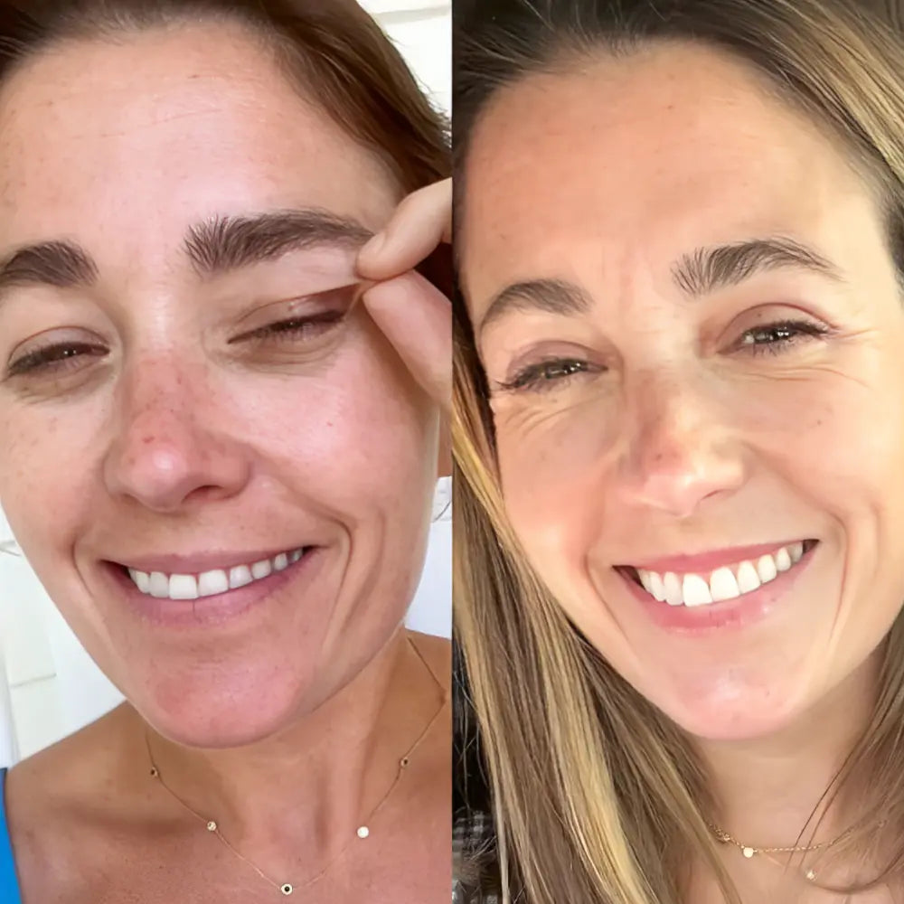 Rédelisse™ Red Light Eye Massager